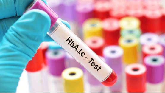 Что такое тест на гликированный гемоглобин (HbA1c)?